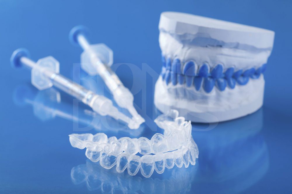 Стоимость системы укрепления эмали зуба в стоматологии