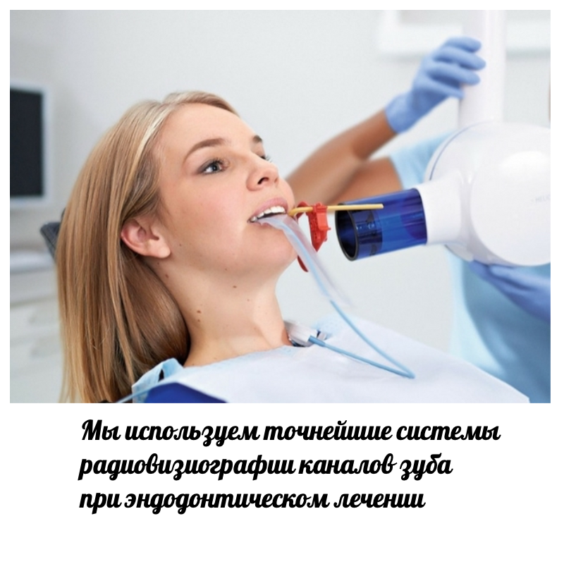 лечение пульпита зуба лазером